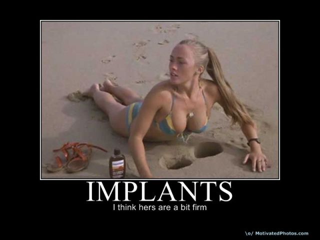 633923575106694255-implants