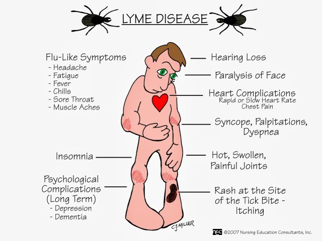 Lyme Disease